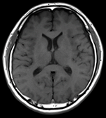 fig06